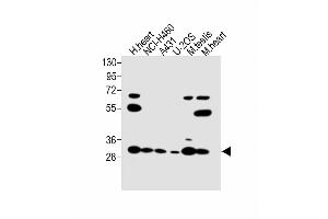 Image no. 4 for anti-Voltage-Dependent Anion Channel 3 (VDAC3) (AA 156-183) antibody (ABIN1537893)