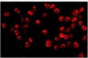 ACIN1 antibody  (C-Term)
