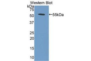 Image no. 1 for anti-Bone Morphogenetic Protein 5 (BMP5) (AA 317-454) antibody (ABIN1175488)
