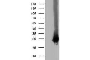 Image no. 2 for anti-RAB, Member of RAS Oncogene Family-Like 2A (RABL2A) antibody (ABIN2730382)