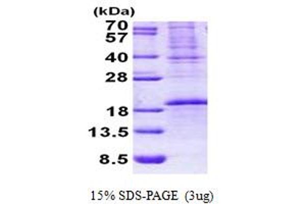 OCIAD2 Protein (AA 1-154) (His tag)
