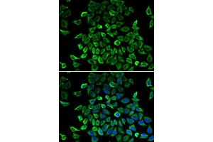 Image no. 3 for anti-BCL2-Like 13 (Apoptosis Facilitator) (BCL2L13) antibody (ABIN1512626)