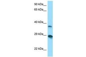 Image no. 1 for anti-V-Set and Immunoglobulin Domain-Containing Protein 4 (VSIG4) (AA 40-89) antibody (ABIN6748427)