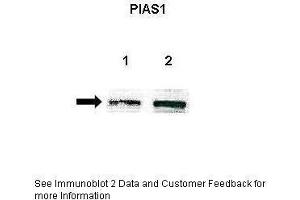 Image no. 3 for anti-Protein Inhibitor of Activated STAT, 1 (PIAS1) (Middle Region) antibody (ABIN2780998)