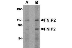 Image no. 2 for anti-Folliculin Interacting Protein 2 (FNIP2) (C-Term) antibody (ABIN499853)