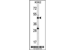Image no. 1 for anti-Adenylosuccinate Synthase (ADSS) (AA 396-422), (C-Term) antibody (ABIN657016)