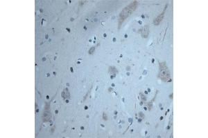 Image no. 4 for anti-Solute Carrier Family 18 (Vesicular Acetylcholine), Member 3 (SLC18A3) (C-Term) antibody (ABIN571640)