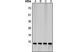 Image no. 3 for anti-Eukaryotic Translation Initiation Factor 4E Binding Protein 1 (EIF4EBP1) (N-Term) antibody (ABIN2707290)