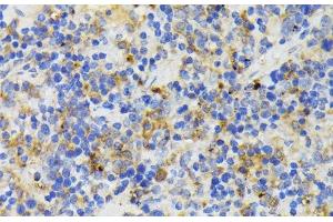 Immunohistochemistry of paraffin-embedded Mouse spleen using TREM2 Polyclonal Antibody at dilution of 1:200 (40x lens).