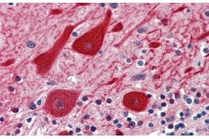 Image no. 3 for anti-Empty Spiracles Homeobox 2 (EMX2) (N-Term) antibody (ABIN2777391)