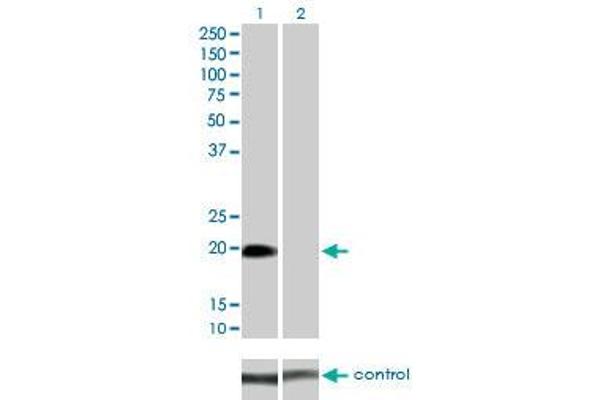 STK32A Antikörper  (AA 1-166)