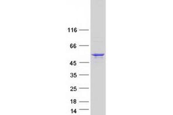 Septin 14 Protein (SEPT14) (Myc-DYKDDDDK Tag)