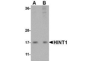 Image no. 2 for anti-Histidine Triad Nucleotide Binding Protein 1 (HINT1) (Center) antibody (ABIN499948)