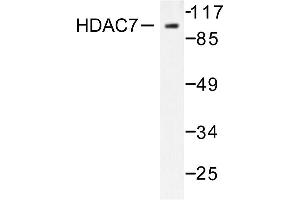 Image no. 1 for anti-Histone Deacetylase 7 (HDAC7) antibody (ABIN265459)