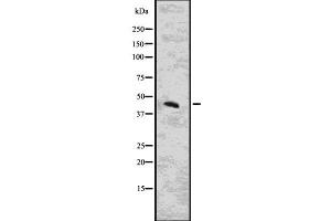 Image no. 1 for anti-Cytohesin 3 (CYTH3) (Internal Region) antibody (ABIN6261176)