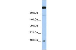 Image no. 1 for anti-WW Domain Binding Protein 5 (WBP5) (N-Term) antibody (ABIN2775803)