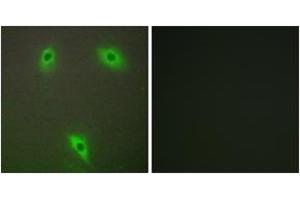 Image no. 2 for anti-Kelch-Like 3 (KLHL3) (AA 10-59) antibody (ABIN1534174)