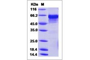 Image no. 1 for Methionyl Aminopeptidase 2 (METAP2) (AA 1-478) protein (His tag) (ABIN2693515)
