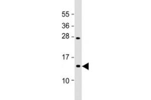 Image no. 1 for anti-Eukaryotic Translation Initiation Factor 1A (EIF1A) (AA 31-61) antibody (ABIN5647971)