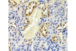 Immunohistochemistry of paraffin-embedded Mouse kidney using CDKN1B Polyclonal Antibody at dilution of 1:200 (40x lens).