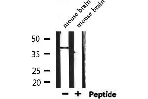 Image no. 1 for anti-Taste Receptor, Type 2, Member 40 (TAS2R40) (Internal Region) antibody (ABIN6265460)