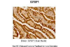 Image no. 4 for anti-Insulin-Like Growth Factor 2 mRNA Binding Protein 1 (IGF2BP1) (N-Term) antibody (ABIN2778994)