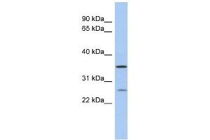 Image no. 1 for anti-Short Chain Dehydrogenase/reductase Family 9C, Member 7 (SDR9C7) (Middle Region) antibody (ABIN632990)