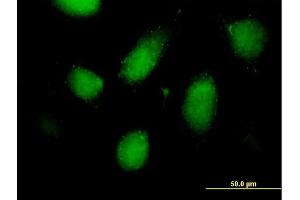 Image no. 2 for anti-Regulatory Solute Carrier Protein, Family 1, Member 1 (RSC1A1) (AA 1-617) antibody (ABIN519923)