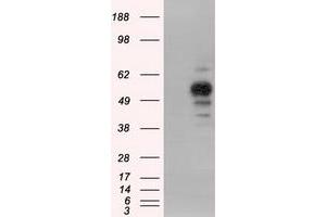 Image no. 1 for anti-Protein Kinase, CAMP-Dependent, Regulatory, Type II, alpha (PRKAR2A) antibody (ABIN2729600)