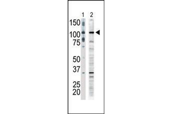 anti-Mitogen-Activated Protein Kinase Kinase Kinase 9 (MAP3K9) (AA 1070-1104), (C-Term) antibody