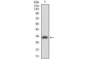 Image no. 4 for anti-Integrin alpha 4 (ITGA4) antibody (ABIN969530)