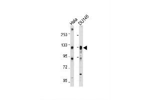 Image no. 4 for anti-AXL Receptor tyrosine Kinase (AXL) antibody (ABIN391878)