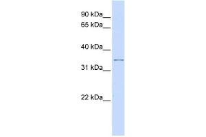 Image no. 1 for anti-Potassium Channel Regulator (KCNRG) (Middle Region) antibody (ABIN633660)