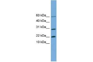 Image no. 2 for anti-Proline Rich 13 (PRR13) (N-Term) antibody (ABIN2787137)
