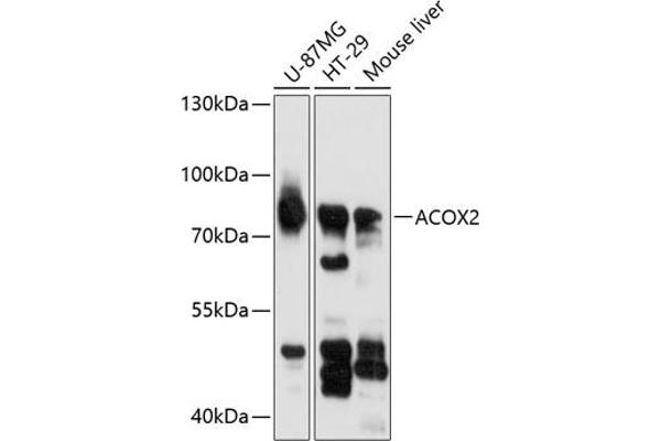 Acox2 anticorps  (AA 1-150)