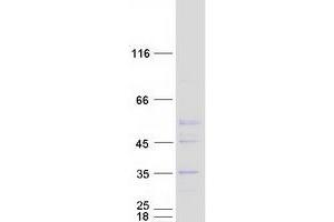 Image no. 1 for Elongator Acetyltransferase Complex Subunit 6 (ELP6) protein (Myc-DYKDDDDK Tag) (ABIN2714125)