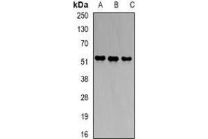 Image no. 1 for anti-Hydroxymethylbilane Synthase (HMBS) (full length) antibody (ABIN6004906)