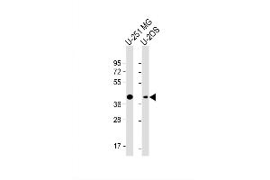 Image no. 5 for anti-Adiponectin Receptor 2 (ADIPOR2) (AA 45-72) antibody (ABIN651298)