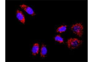 Image no. 2 for ACTN4 & CTNNB1 Protein Protein Interaction Antibody Pair (ABIN1339891)
