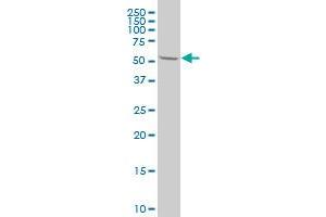HRMT1L3 polyclonal antibody (A01), Lot # 061025JCS1 Western Blot analysis of HRMT1L3 expression in 293 .