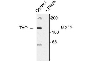 Image no. 1 for anti-TAO Kinase 2 (TAOK2) (pSer181) antibody (ABIN372726)