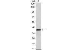 Image no. 3 for anti-Musashi Homolog 1 (Drosophila) (MSI1) antibody (ABIN969294)