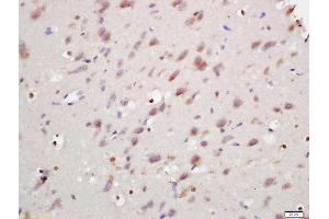 Formalin-fixed and paraffin embedded rat brain labeled with Rabbit Anti-ANKRD9 Polyclonal Antibody, Unconjugated (ABIN2170251) at 1:200 followed by conjugation to the secondary antibody and DAB staining