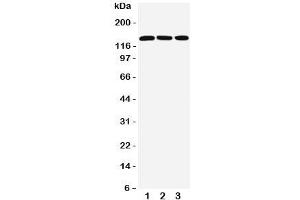 Image no. 2 for anti-Ataxin 2 (ATXN2) (C-Term) antibody (ABIN3028477)