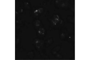 Image no. 3 for anti-ATP-Binding Cassette, Sub-Family A (ABC1), Member 7 (ABCA7) (N-Term) antibody (ABIN6655280)