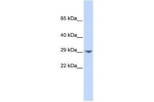 Image no. 1 for anti-Potassium Intermediate/small Conductance Calcium-Activated Channel, Subfamily N, Member 2 (KCNN2) (Middle Region) antibody (ABIN633679)