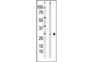 Image no. 1 for anti-Thymidine Kinase 2, Mitochondrial (TK2) (AA 8-38), (N-Term) antibody (ABIN1882141)