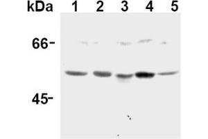 Image no. 3 for anti-Caspase 12 (Gene/pseudogene) (CASP12) (AA 95-318), (N-Term) antibody (ABIN567795)