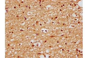 IHC image of ABIN7165514 diluted at 1:200 and staining in paraffin-embedded human brain tissue performed on a Leica BondTM system.
