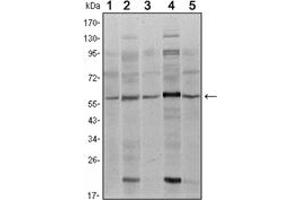 Image no. 3 for anti-SMAD Family Member 4 (SMAD4) antibody (ABIN1109061)